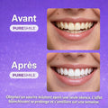 Bandes blanchissantes Pure Smile - Kit